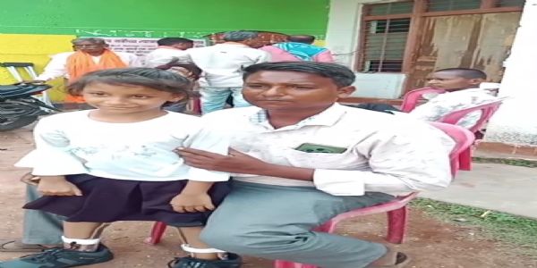 लावण्या के नन्हे कदमों को मिला ‘निदान’ का सहारा, कैलिपर से जगी आत्मनिर्भरता की उम्मीद