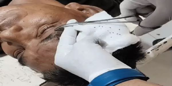 देवास में जवारा विसर्जन के दौरान मधुमक्खियों का हमला, 40 लोग घायल, एक युवक की हालत गंभीर