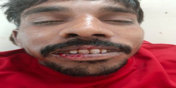 राजगढ़ः खेत पर जाने का कहकर निकला युवक, कुएं में मिला शव