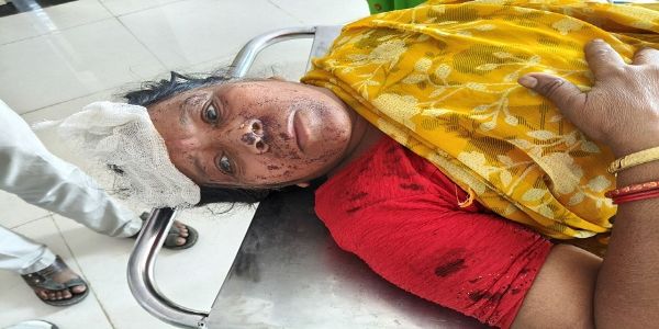 हरदा में अस्पताल के वार्ड में बुजुर्ग महिला से मारपीट, युवती के खिलाफ एफआईआर