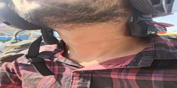 मंदसौरः रेलवे ब्रिज पर पतंग की खतरनाक डोर से बड़ा हादसा टला