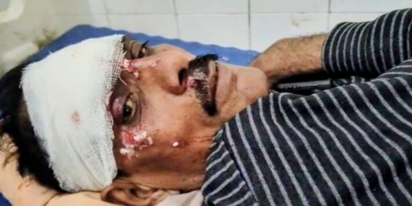 पत्रकार को बाइक से कुचलने की कोशिश, पुलिस जांच में जुटी