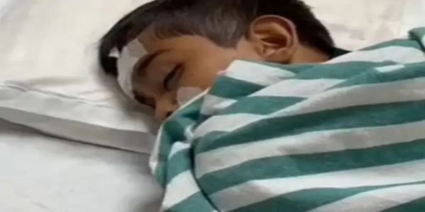 कोरबा : ट्रांसफार्मर के खुले तारों की चपेट में आया आठ वर्षीय बच्चा, गंभीर रूप से झुलसा