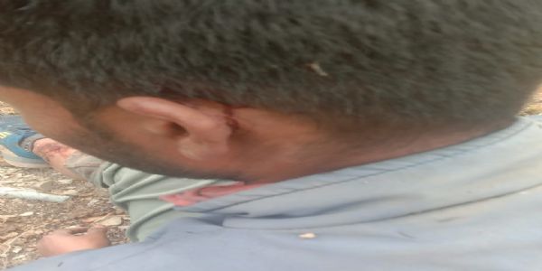 उत्तरकाशी में भालू का हमला जारी, एक व्यक्ति घायल