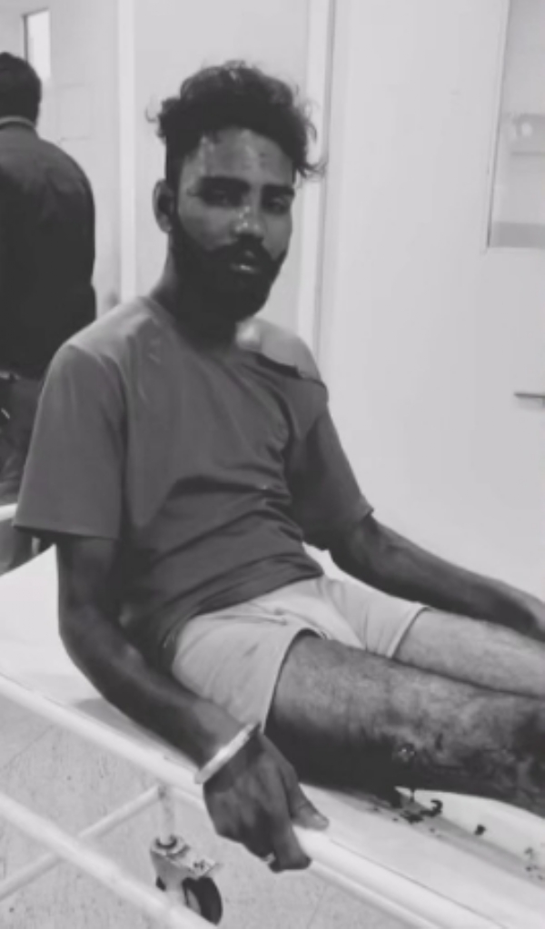 घायल चिराग सिंह घायल चिराग सिंह