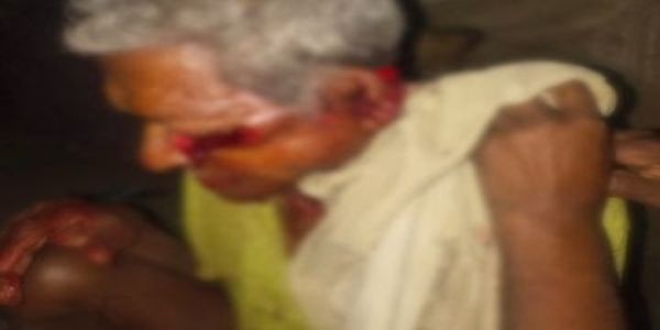 कोरबा में बुजुर्ग पर धारदार हथियार से हमलाकर आंख निकाली, हालत गंभीर