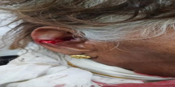 महिला पर तेंदुए का हमला, ग्रामीणों के शोर से बची जान