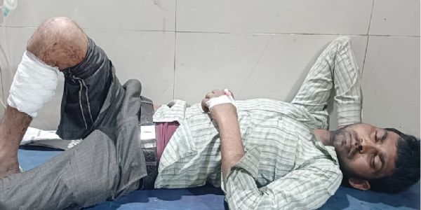 मुठभेड़ में नाबालिग से दुष्कर्म का आरोपित गिरफ्तार, पैर में गोली लगी