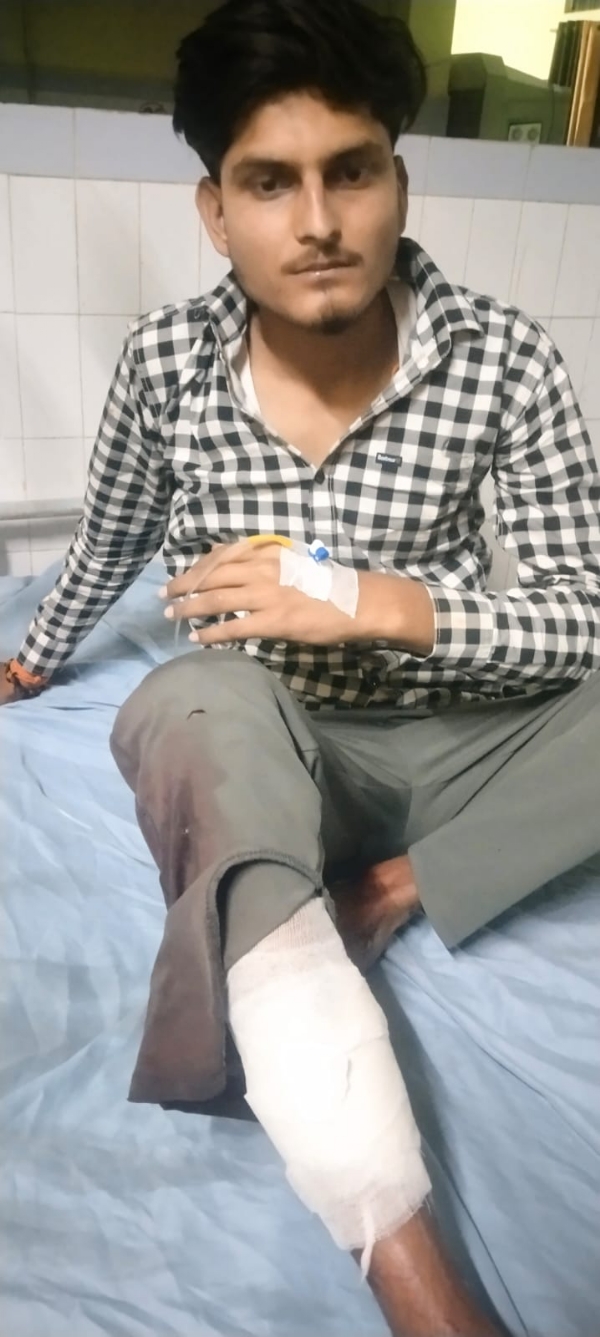 पुलिस  मुठभेड़ में घायल अभियुक्त