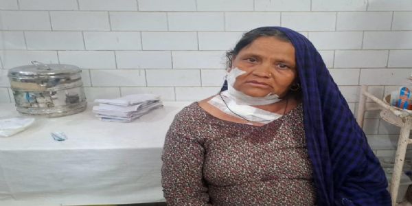 खेत में काम कर रही महिला को गुलदार ने हमला कर किया घायल