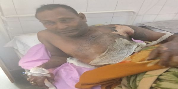 भदोही में बाप -बेटे पर लगा सगे भाई को पेट्रोल डालकर जलाने आरोप