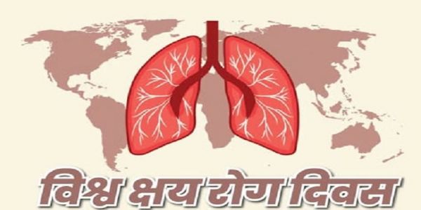 मप्र में आज विश्व क्षय दिवस पर होगा 100 दिवसीय निक्षय शिविर अभियान का शुभारंभ