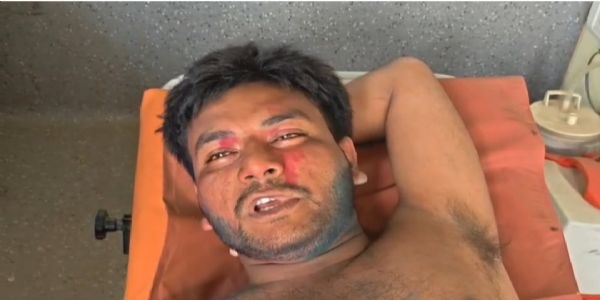 दाउदपुर में रंग फेंकने के विवाद में युवक को मारा चाकू