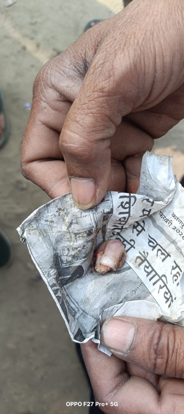 आरोपित द्वारा दांतो से काटी गई दुकानदार की उंगली