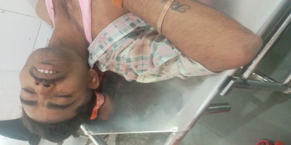 देवरिया में मरम्मत के समय हाईटेंशन लाइन में अचानक करंट आने से दो लाइनमैन झुलसे