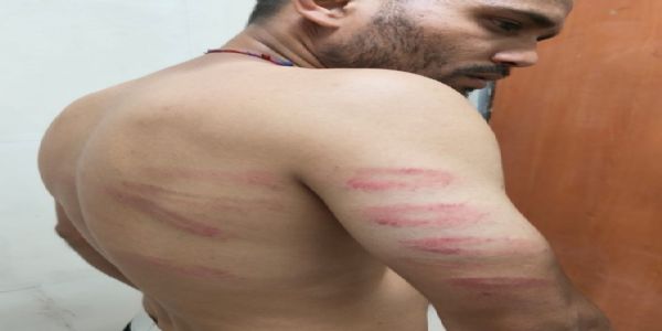 अमरनाथ यात्रा रजिस्ट्रेशन के दौरान युवक ने पुलिस पर मारपीट का लगाया आरोप