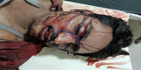 राजगढ़ः बारात में नाचते समय भगदड़, तीन युवक कुएं में गिरे, एक की मौत, दो घायल