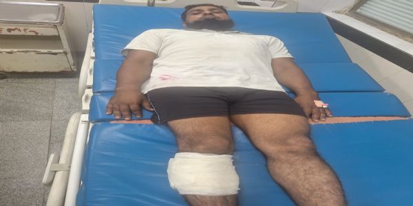 नूंह में मुठभेड़ के बाद गो-तस्करी का वांछित आरोपी काबू