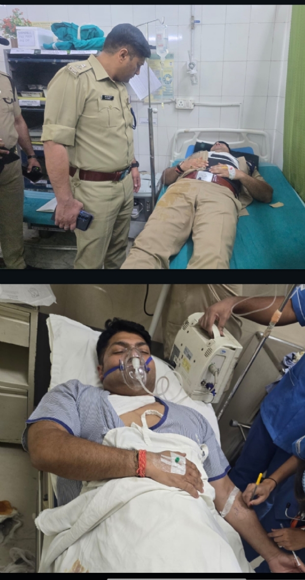 मुठभेड़ में घायल बदमाश अस्पताल में भर्ती।