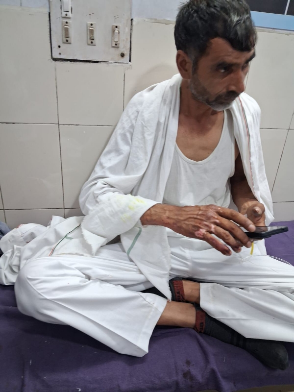 नागरिक अस्पताल में उपचाराधीन घायल।