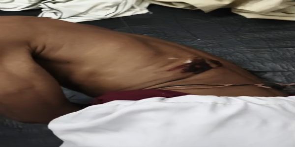 तिलक समारोह में हर्ष फायरिंग में पंडित और बाराती को लगी गोली,पूर्व मुखिया गिरफ्तार