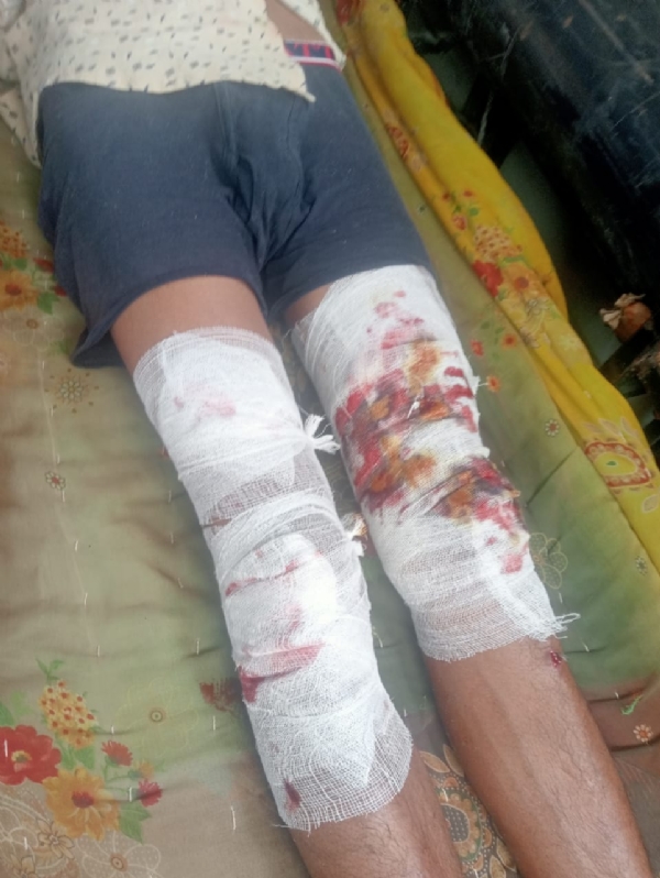 घायल युवक घायल युवक