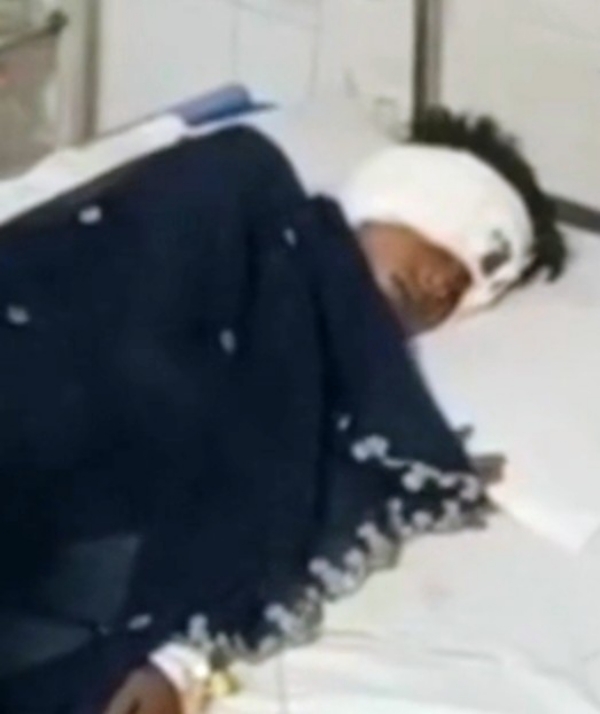 जानवर के हमले में घायल किशोरी जानवर के हमले में घायल किशोरी