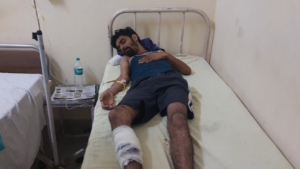 नागरिक अस्पताल में भर्ती गोली लगने के बाद घायल हुआ बदमाश संदीप।