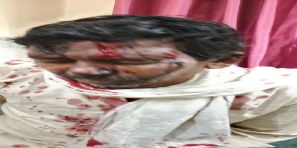 श्योपुरः वीरपुर के नहेलापुरा में जाटव-रावत समाज के बीच खूनी संघर्ष, लाठी-डंडो व कुल्हाड़ी से किया हमला