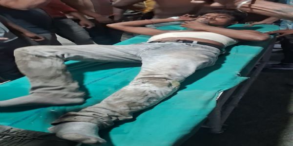 बशीरहाट में भाजपा कार्यकर्ता को मारी गोली, हालत गंभीर