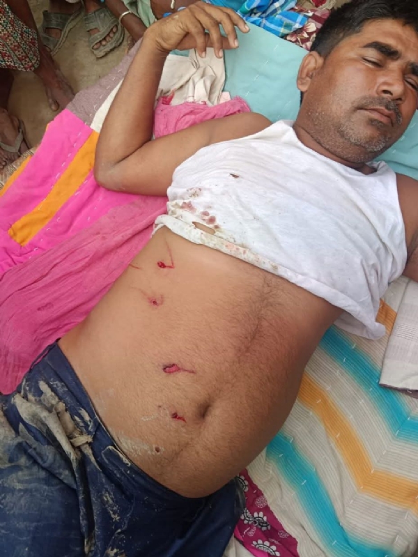 तेंदुए के हमले से जख्मी किसान तेंदुए के हमले से जख्मी किसान