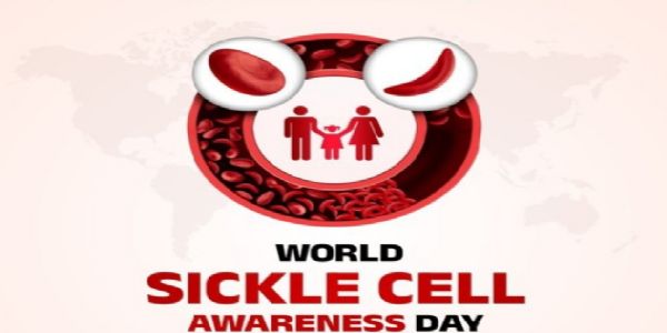 विश्व सिकल सेल जागरूकता दिवस (प्रतीकात्मक चित्र)। विश्व सिकल सेल जागरूकता दिवस (प्रतीकात्मक चित्र)।