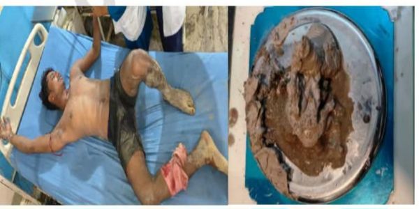 नेपाल के सिरहा में दो भारतीय ड्रग्स तस्कर गिरफ्तार, पुलिस कार्रवाई में एक घायल