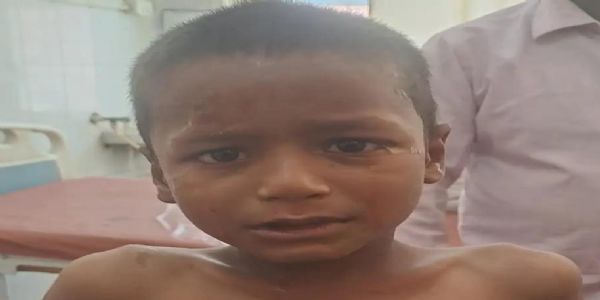 ई रिक्शा की टक्कर से बालक घायल