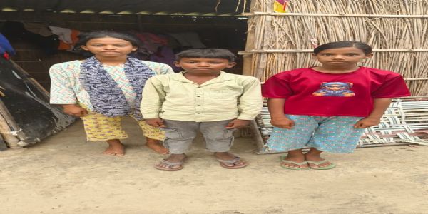 बिहार में सीवान जिले के बिंद टोली में चिकन पॉक्स का विस्फोट, हर घर में मरीज