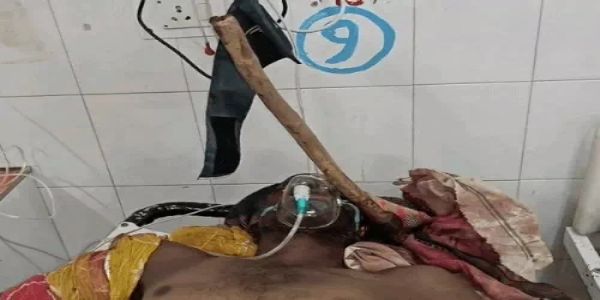 सोते युवक पर कुल्हाड़ी से जानलेवा हमला, सिर में धंसा हथियार; गंभीर हालत में कोटा रेफर