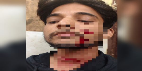 अम्बिकापुर में गाली देने से मना करने पर डांस टीचर के भाई पर चाकू से जानलेवा हमला, हालत गंभीर