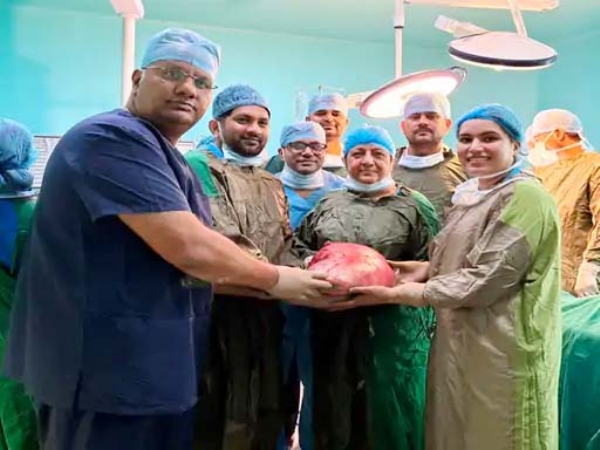 महिला के पेट से निकाले ट्यूमर को दिखाते डाक्टर महिला के पेट से निकाले ट्यूमर को दिखाते डाक्टर