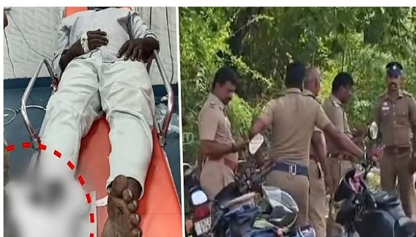 चेन्नई में बदमाश को पुलिस ने गोली मारकर किया गिरफ्तार चेन्नई में बदमाश को पुलिस ने गोली मारकर किया गिरफ्तार