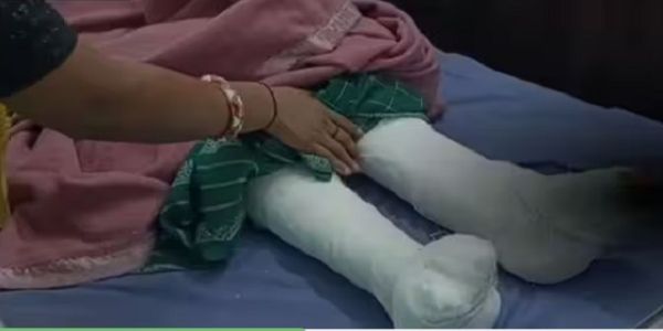 पति ने कुल्हाड़ी से पत्नी पर किया हमला, दोनों पैरों में गंभीर चोट; आरोपित फरार