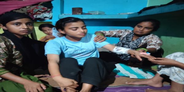 बंदरों के हमले में किशोरी घायल