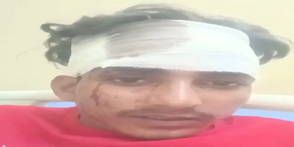 कैथल: नशे की सूचना देने के शक में युवक पर गंडासी से हमला
