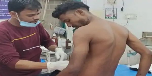 अनूपपुर: सड़क पर लड़ रहे मवेशी से बाइक चवार युवक से टकराया, कंधे की हड्डी टूटी