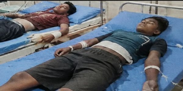 तालाब में नहाने गए दो किशोरों पर गिरी आकाशीय बिजली, गंभीर रूप से झुलसे