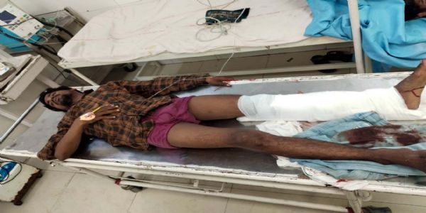 हिसार पुलिस ने मुठभेड़ में पकड़े तीन बदमाश, दो के पैर में लगी गोली