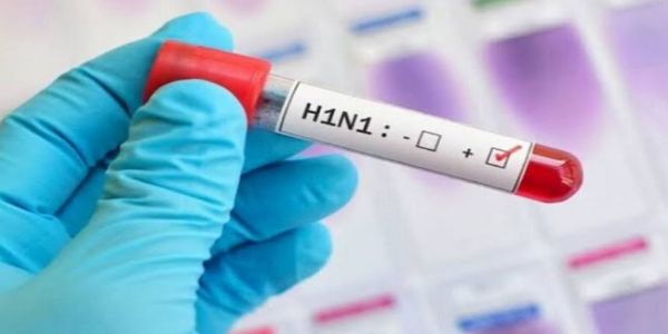 मप्र के इंदौर में स्वाइन फ्लू से एक माह में दूसरी मौत, महिला ने उपचार के दौरान तोड़ा दम