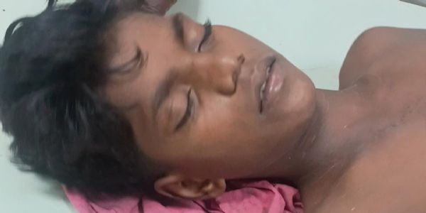 देवरिया : स्कूल में आकाशीय बिजली गिरी, चपेट में आने से कक्षा सात का छात्र झुलसा