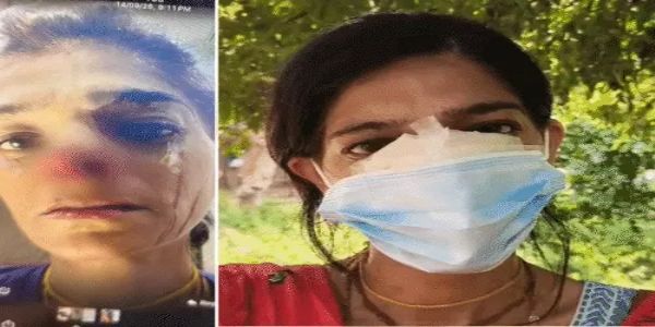 गोवर्धन : परिक्रमा मार्ग में श्रद्धालु युवती पर हमला, नाक काटकर आभूषण लेकर भागा सिरफिरा युवक