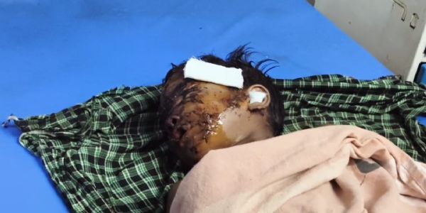 लेमरू में झरने के पास भालू का हमला, 13 वर्षीय बच्चे को किया घायल