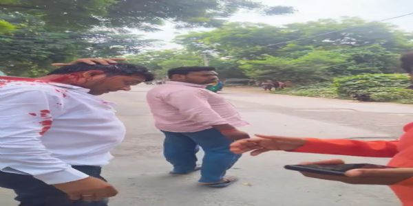 जौनपुर : ग्राम विकास अधिकारी पर रॉड-लाठी से हमला, सरकारी दस्तावेज और डोंगल छीने